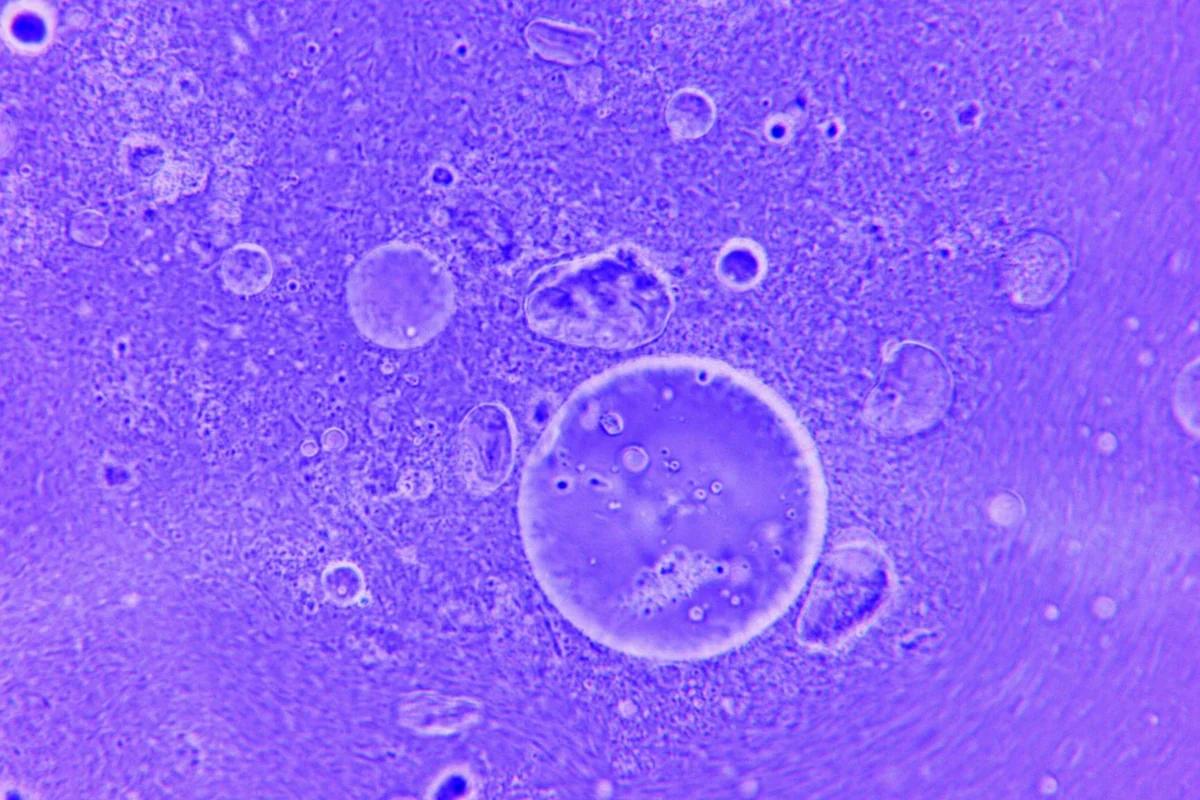 宇宙微小重力環境竟讓精子「迷路」！研究揭人類太空繁殖難度大增